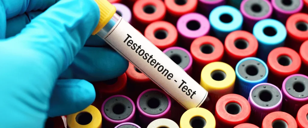 Navigating Testosterone Replacement Therapy (TRT) for Optimal Wellness - Blog