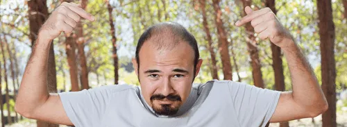 Hair Loss in Men: When It’s More Than Just Genetics - Blog