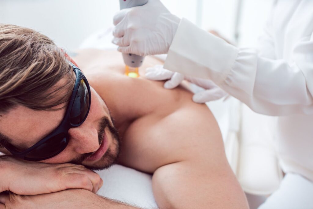 How to Prep for Laser Hair Removal: Complete Guide for the Best Results - Blog