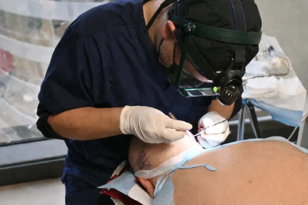 Corrective Transplants