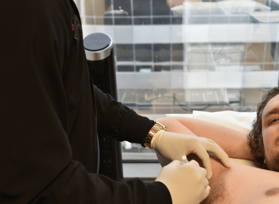 Botox for sweating being applied to a man at Dallas Men's Health
